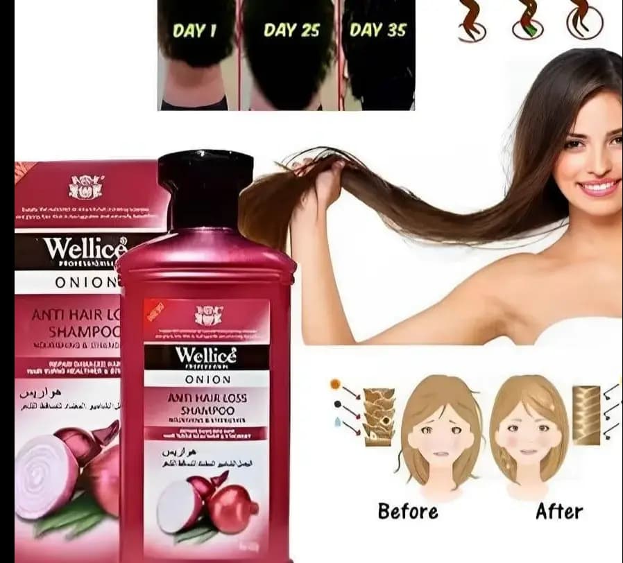 Anti-Hair Loss Onion Shampoo